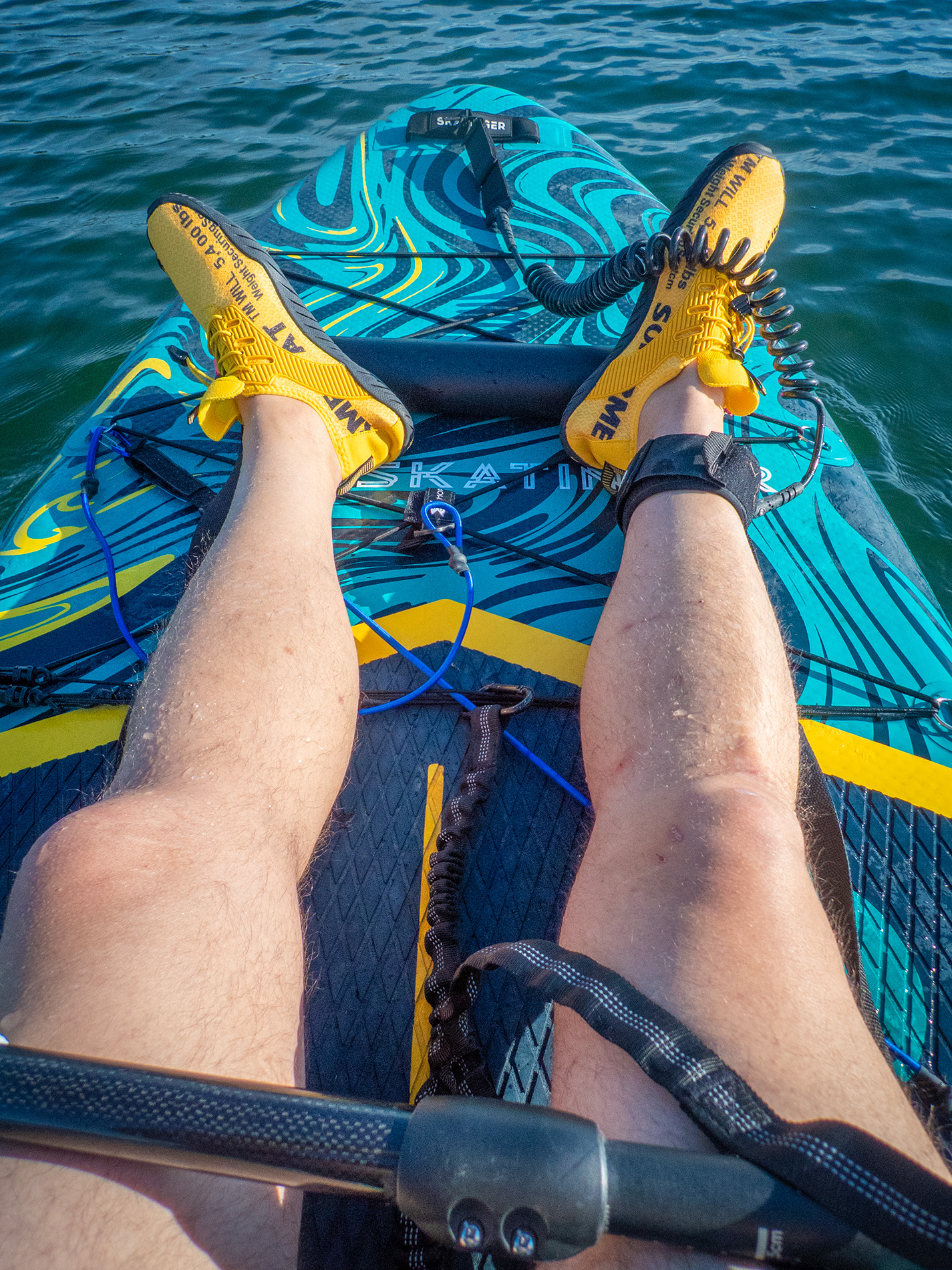 Sexy legs, Chestermere Lake, Chestermere, AB, 2025-06-16